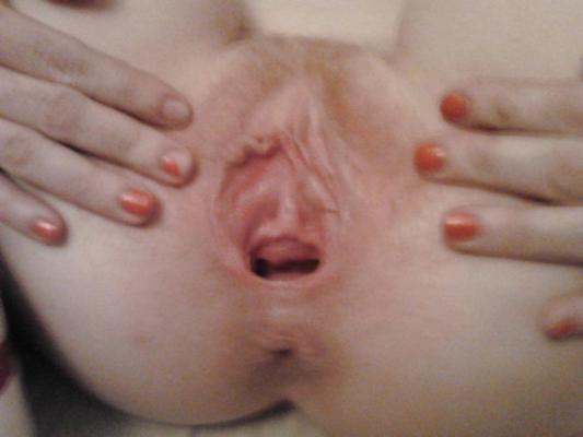 4P Hot gape