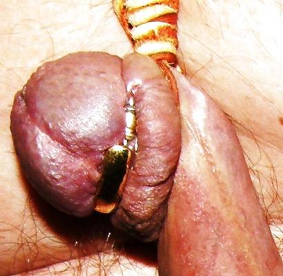 13P CBT