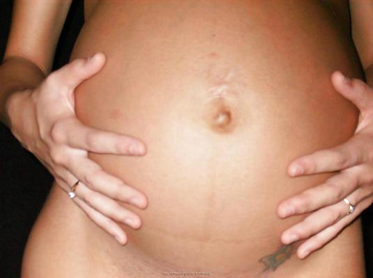 25P Pregnant Misc 