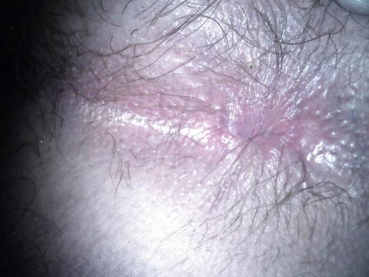 6P My butt hole needs a big hard