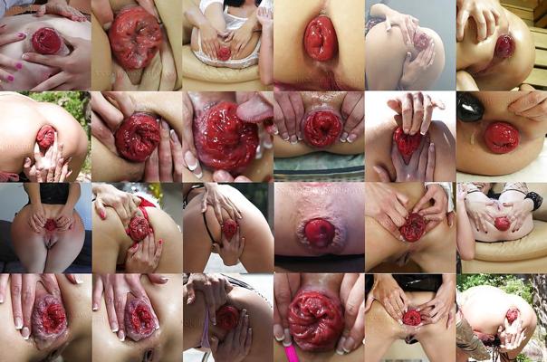 4P Compilation Anal