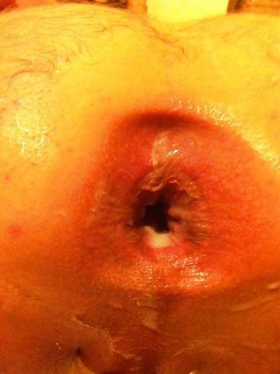 4P Latest Gape Pictures