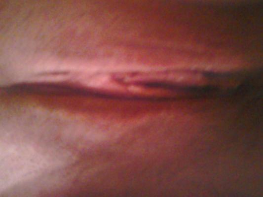 5P Hot girl flashing
