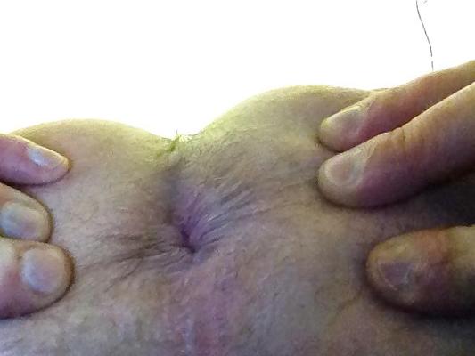 8P Anus for use