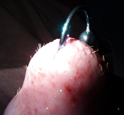 8P Pierced cock with hundreds of splinters in glans