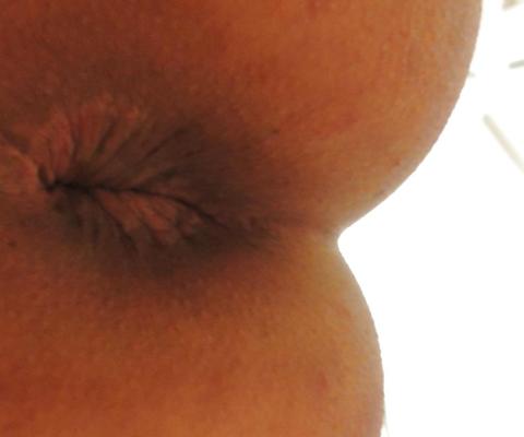 11P Teen girlie butthole april 2013
