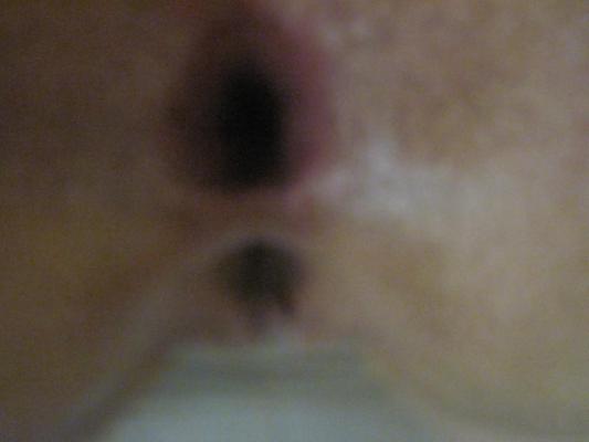 6P My gape