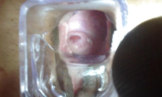 4P Cervix, speculum, open wide pussy