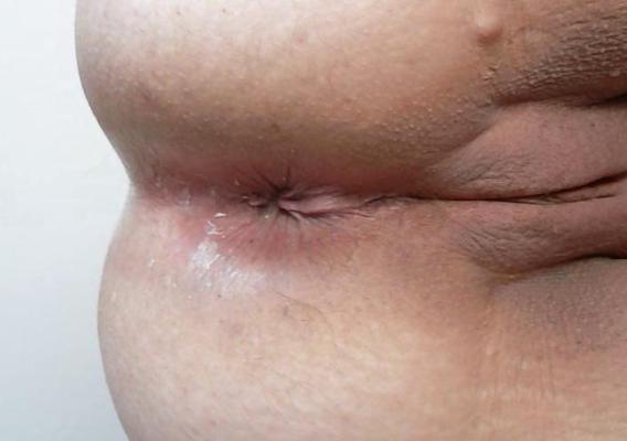 25P Buttholes From Moms (Pick One)