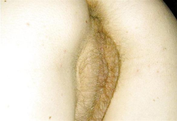 25P Hot Amateur hairy pregnant 