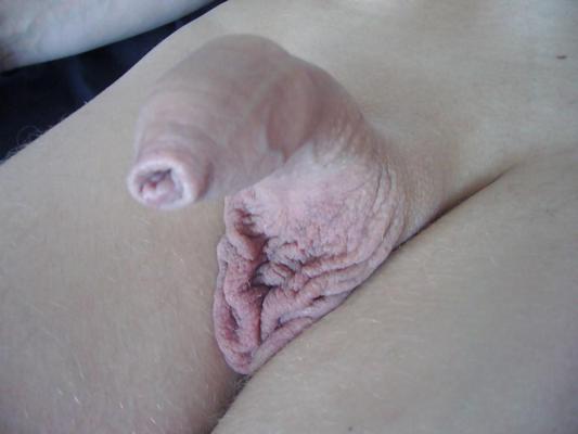 8P No balls