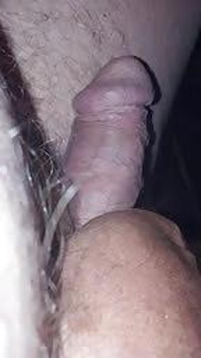 5P Hairy or smooth