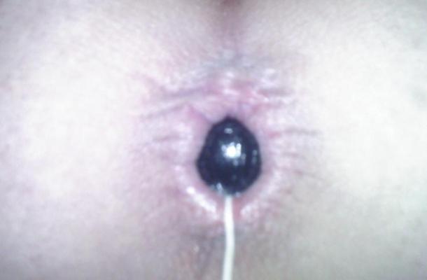 6P Anal beads