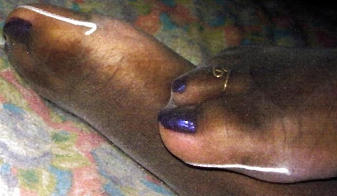 20P Stocking Toes