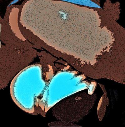 19P Study of butt