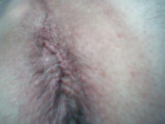 8P Close up