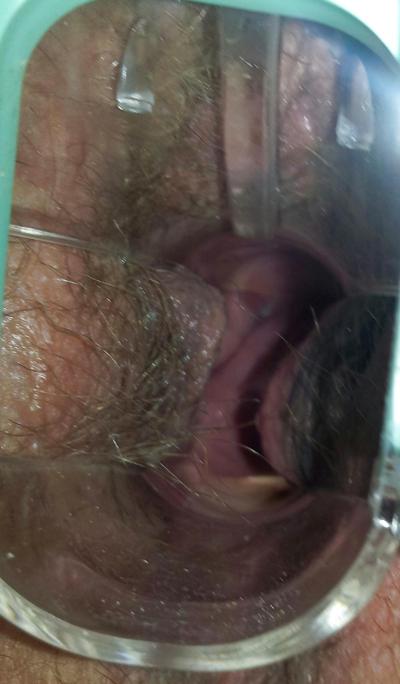 17P 自宅で婦人科検査を受ける妻