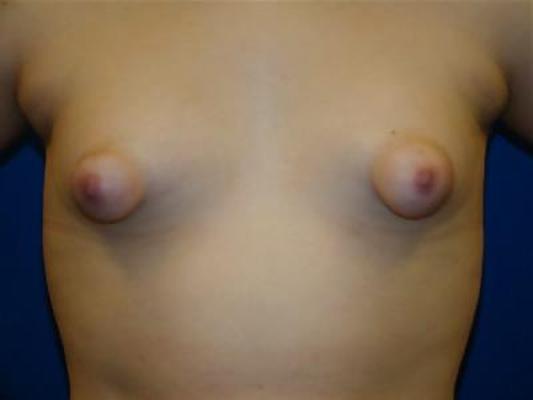 15P Puffy nipples 6