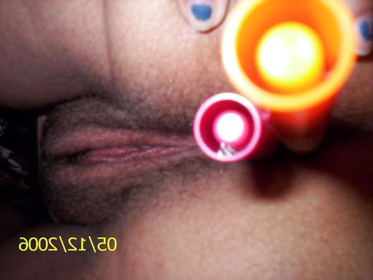 5P Marker-Analsex