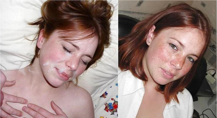 22P Before and After Facials
