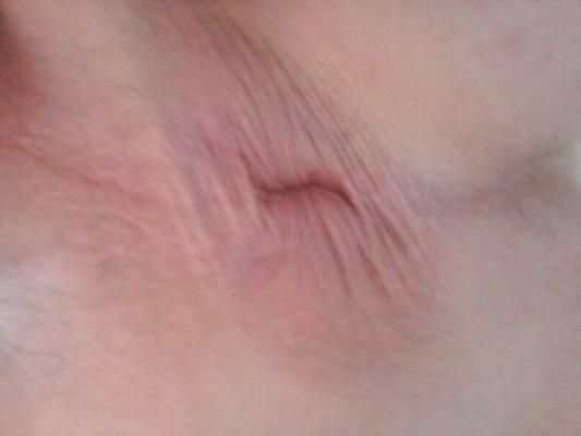 11P Asshole bit gaping