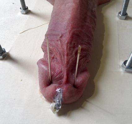 6P Cbt Needle Extrem