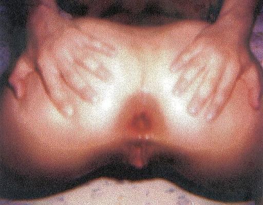 4P Anal Pics Close-Up By X