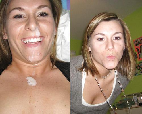 10P Facial Before after