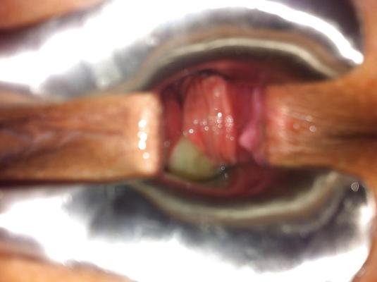 14P TOPBICHE anal speculum gaping ! 