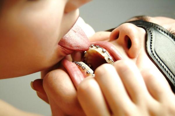 18P Cum on My Braces, Mister 2