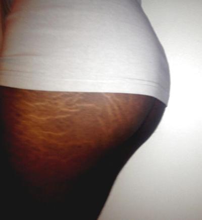 4P Virgin ass