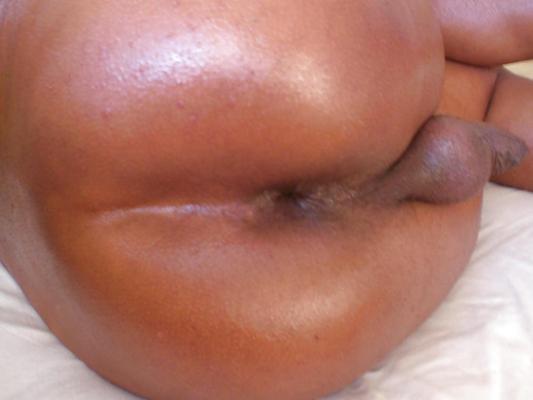 20P Oiled