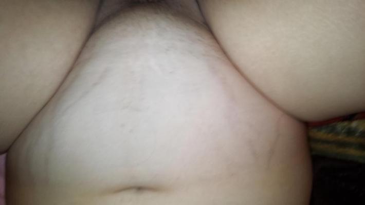 17P Big belly