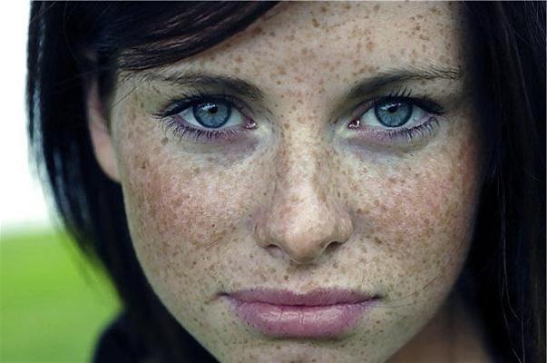 15P Freckled Teens