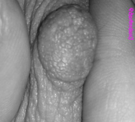 4P Fingers vs nipples (B&W)
