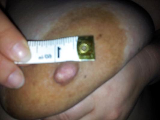 18P Prego Huge Areola Woman