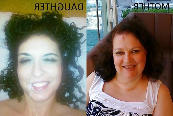 13P Before and After Facials