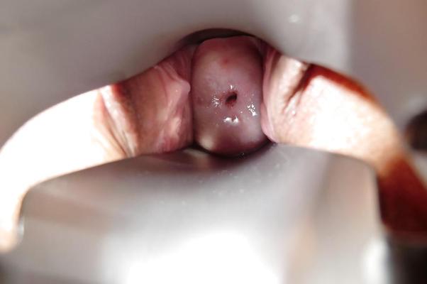 8P Alysha's Gyno Speculum play