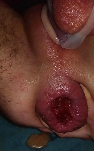 5P Nice gaping male cunt