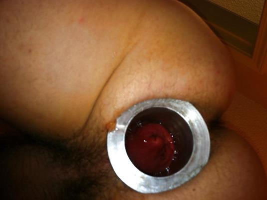5P Hungry Anus 2