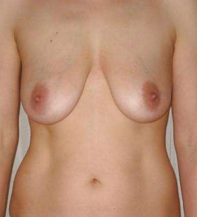 4P Tits closeup...