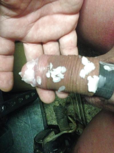 10P Pouring hot candle wax on my cock.