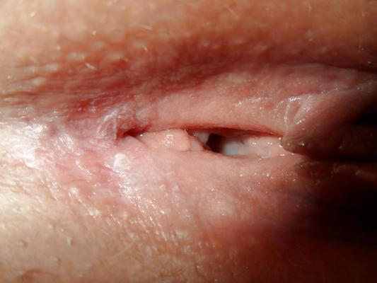 25P ASS AND PUSSY nice wet pussy