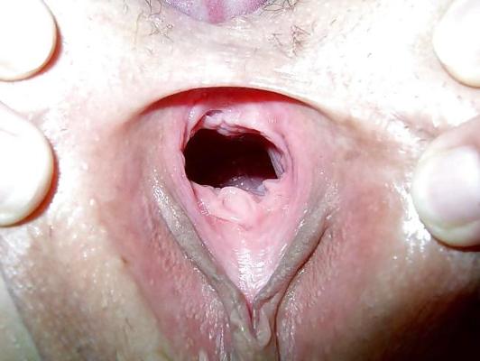 7P GAPE - 2