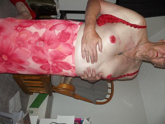 25P Nipple abuse for Master