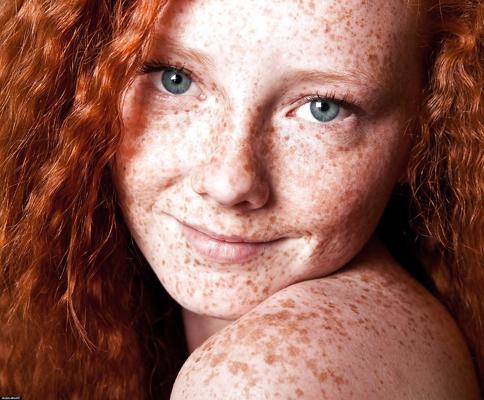13P Lovely  Freckles