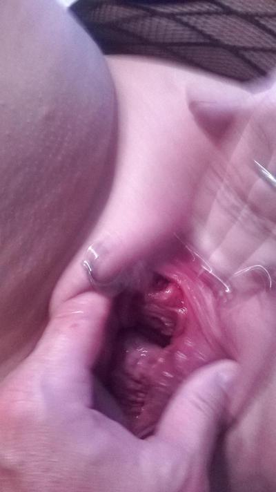 7P Scottish slut , even more tit !