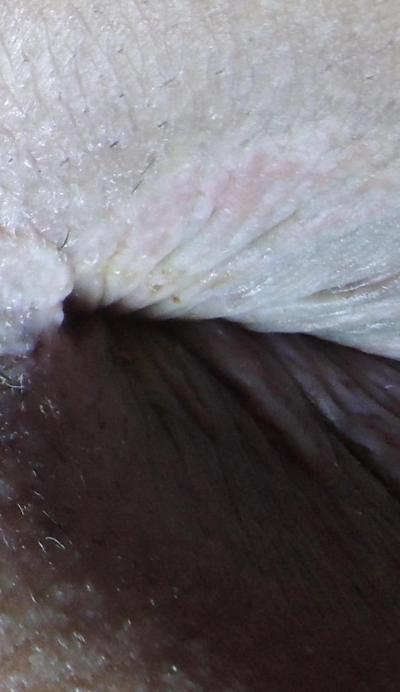 13P My well used butthole