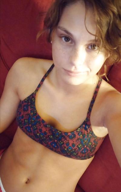 24P Freckled girls