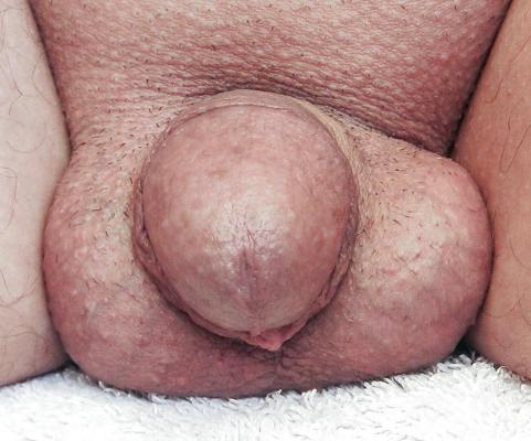 4P Mon pénis, mon Eier